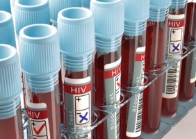 Ministério da Saúde Autoriza Uso de Antirretroviral por Quem está Exposto ao HIV